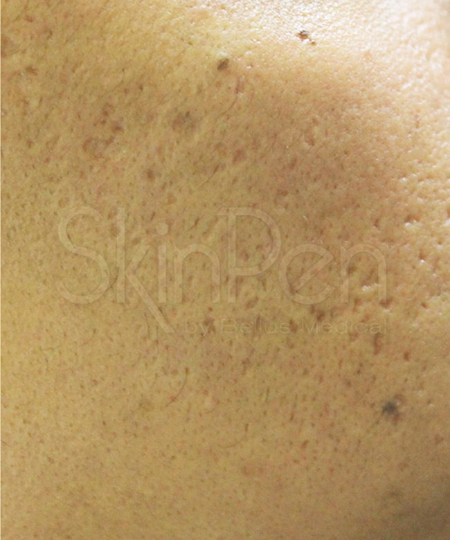 after image