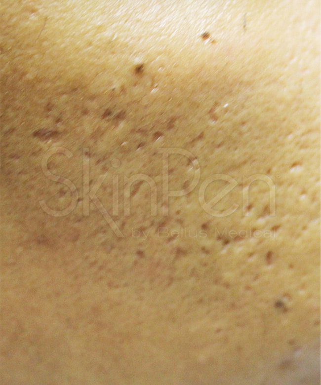 before image