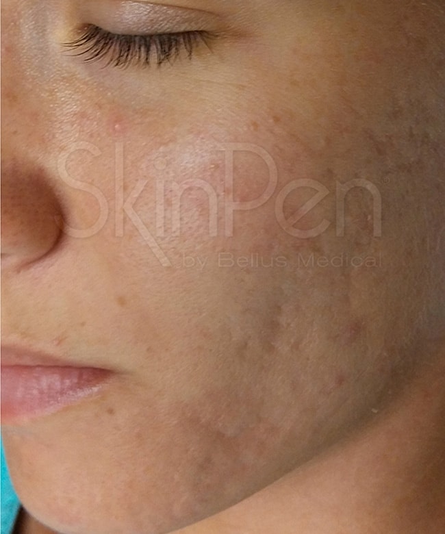 after image