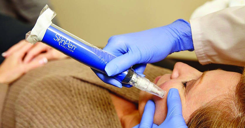Microneedling SkinPen