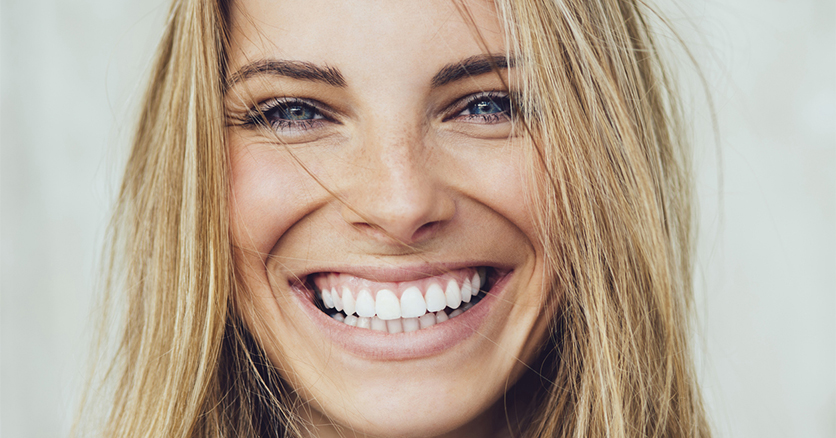 Gummy Smile